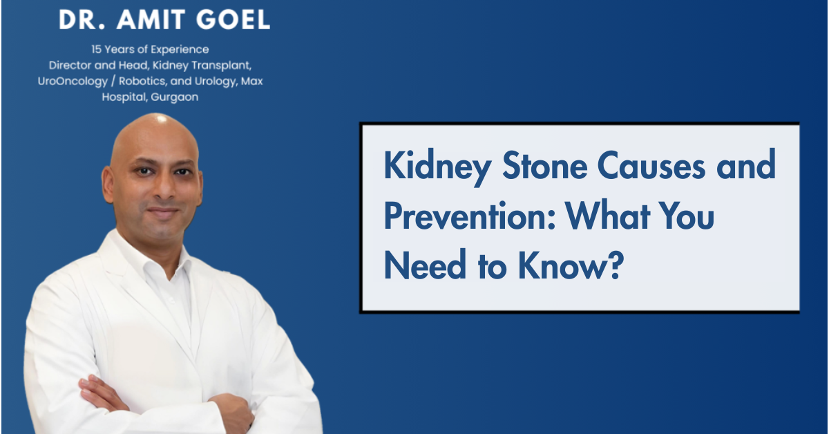Why Kidney Stones Are More Common Than Ever – And How to Prevent Them ...